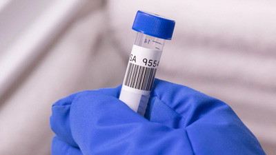 A sample labeled with a 2D barcode.